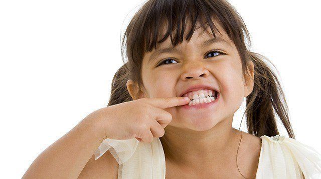 White Spots on Teeth in Toddlers is a Common Problem