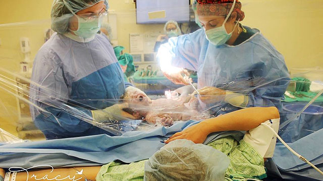 This Mom Got To See Her Baby Being Born Via C-Section