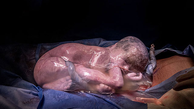 20 Astounding Photos That Show the Beauty of Childbirth