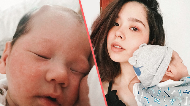 Saab Magalona Reveals Son Has a 'Small Silicone Catheter Under His Scalp'