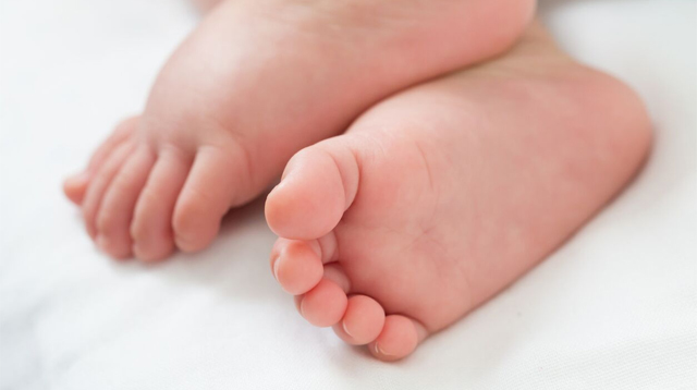 Mom Says Her 8-Week-Old Almost Lost His Toes Because of Her Hair