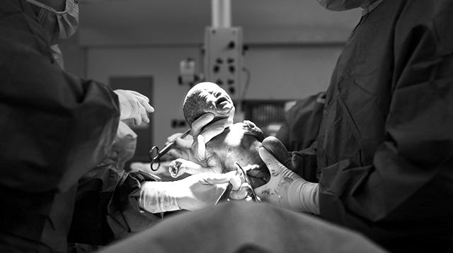 12 Stories of C-Section Delivery: 'I Felt Hands Inside My Stomach'