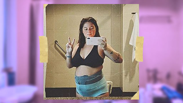 Andi Eigenmann Shares Photo of What She Looks Like Day 1 After C-Section