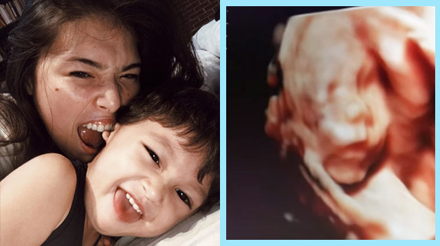 Kylie Padilla and Aljur Abrenica Are Having Another Baby Boy!