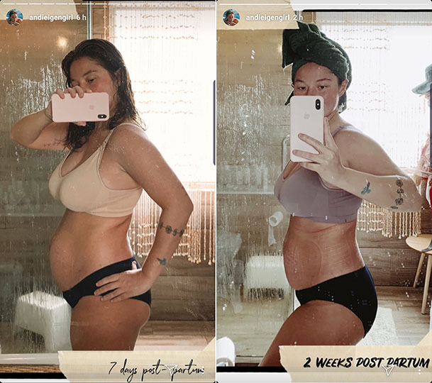 saraaemiliee on Instagram: “Two different body's - both postpartum. One  gained alot of weight during pregnancy a…