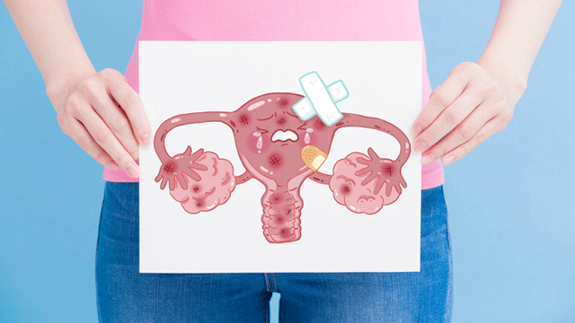 Symptoms of Endometrial Cancer: Heavy Bleeding May Be One of Them