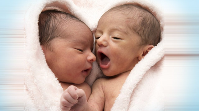 Conjoined Filipino Twins Are Separated Five Months After They Were Born