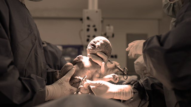 C-section Babies Are More Likely To Develop Asthma, Have A Weakened Immune System