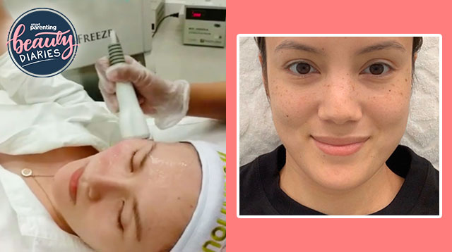 A Mom Tries Venus Freeze, Reportedly Hollywood Celebs' Favorite Beauty Treatment
