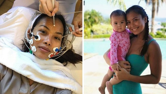 Pregnancy Made This Mom's Skin So Sensitive That Derma Clinics Didn't Know What To Do