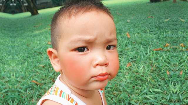 Red Cheeks Can Be A Sign Of A Viral Infection In Your Child