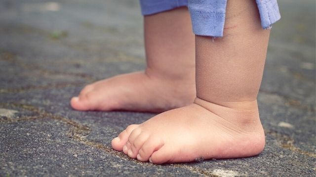 Should You Worry About Your Child's Flat Feet? Moms Whose Kids Have It Share Their Experiences