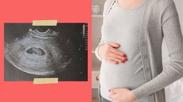 Say Hello To Your Growing Baby! What To Expect During Your Pregnancy Ultrasound At 8 Weeks