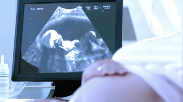 LOOK: Ultrasound Scan Caught Baby Peeing In The Womb!