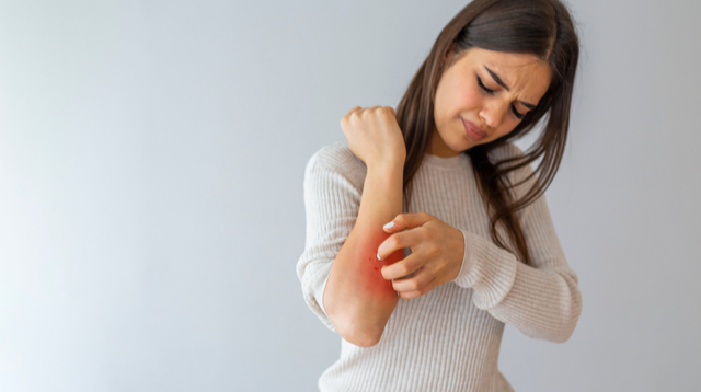 Ang Kati! 6 Home Remedies Sa Itchy Skin Na Rekomendado Ng Derma