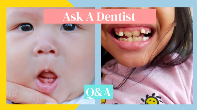 Dentists Answer Questions About Milk Teeth For Baby and Toddler