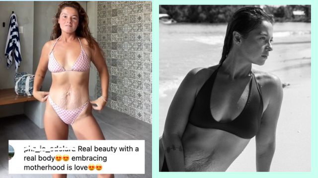 'Real Beauty' Andi Eigenmann Inspires Fellow Moms To Embrace Stretch Marks As Battle Scars