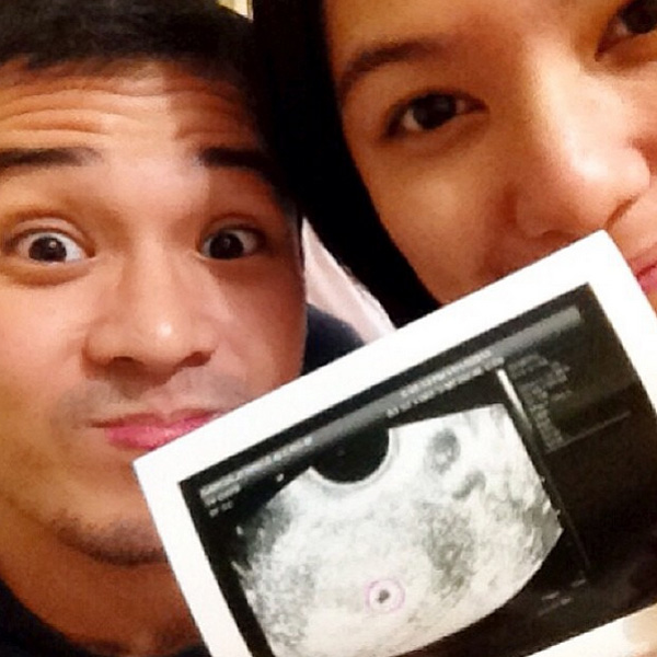 Top of the Morning: Actors Jennica & Alwyn Uytingco Expecting First Child
