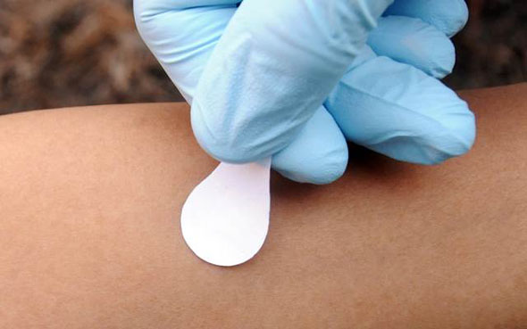 Microneedle vaccine patch