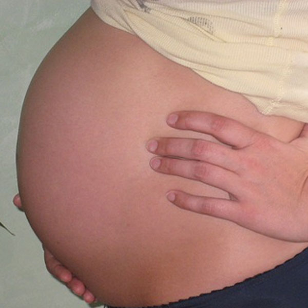 “Eating For Two” When Pregnant Puts Baby at Risk, Says Study