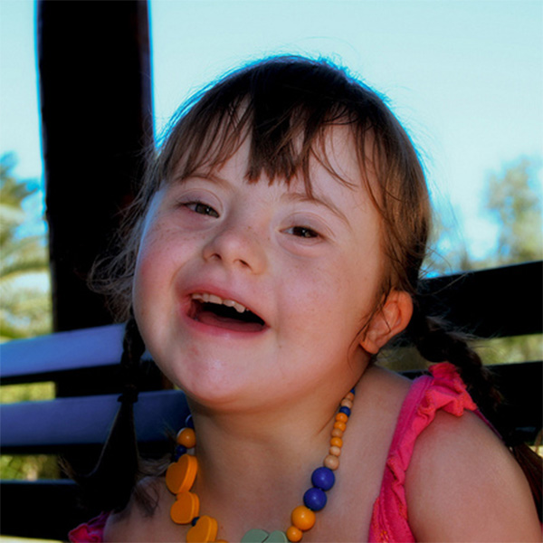 What you Need to Know about Down Syndrome