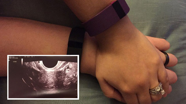 Wearable Tech Tells Woman She's Pregnant!