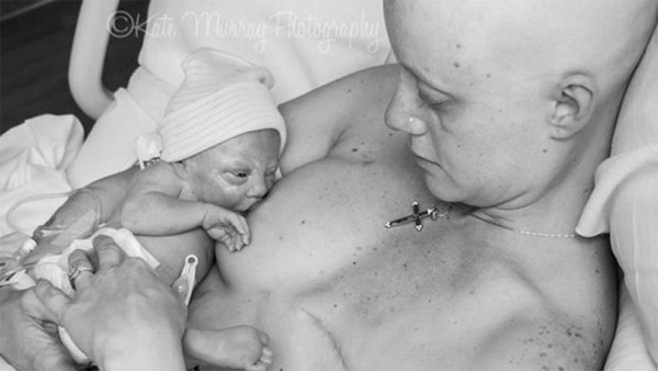woman breastfeeding mastectomy