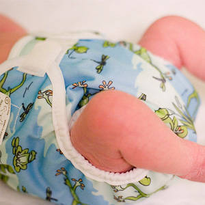4 Mom-recommended Diaper Rash Remedies