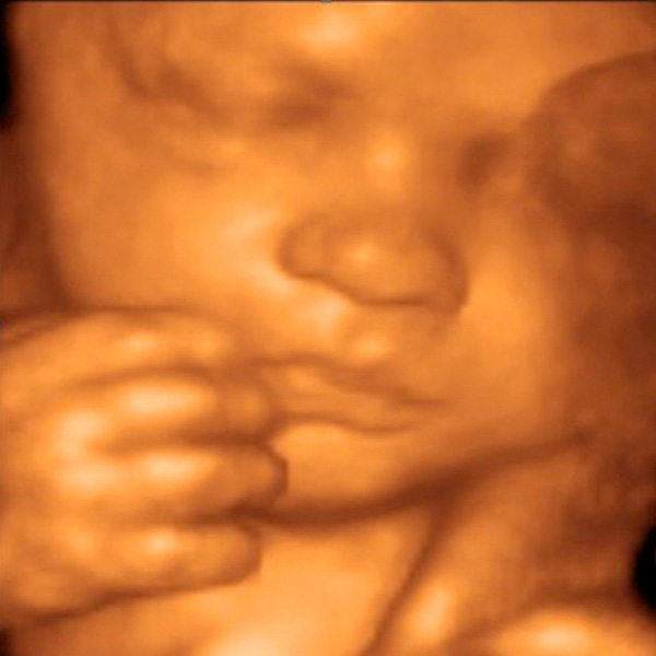 Top of the Morning: Study Releases Ultrasound Images of Babies of Moms Who Smoke