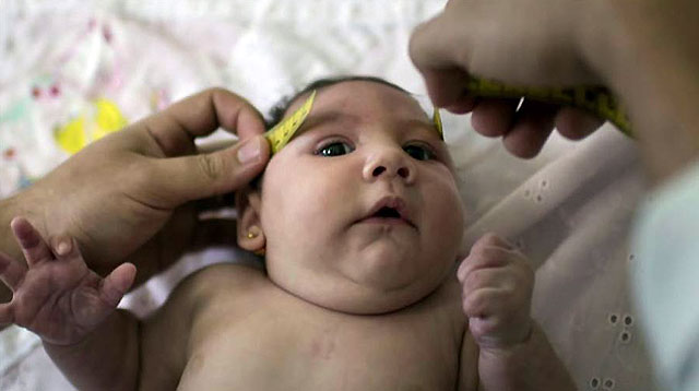 Confirmed: Zika Virus Causes Microcephaly and Other Birth Defects