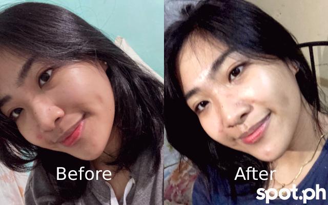Before and After Shots Deoproce Skin Reveal Pomegranate Skin Care
